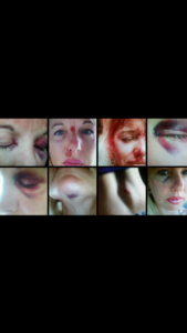 pam abused